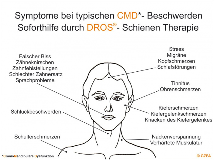 Kiefergelenkstherapie/CMD - Zahnarztpraxis München Zentrum theatiner44 - Dr. Katharina Sensch